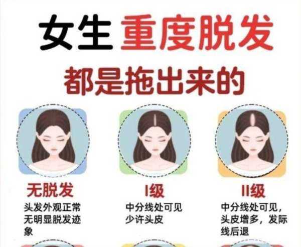 初中生脱发严重怎么治疗才有效呢