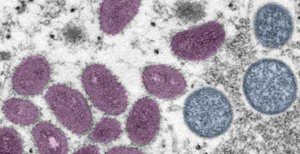 病毒的英语咋说