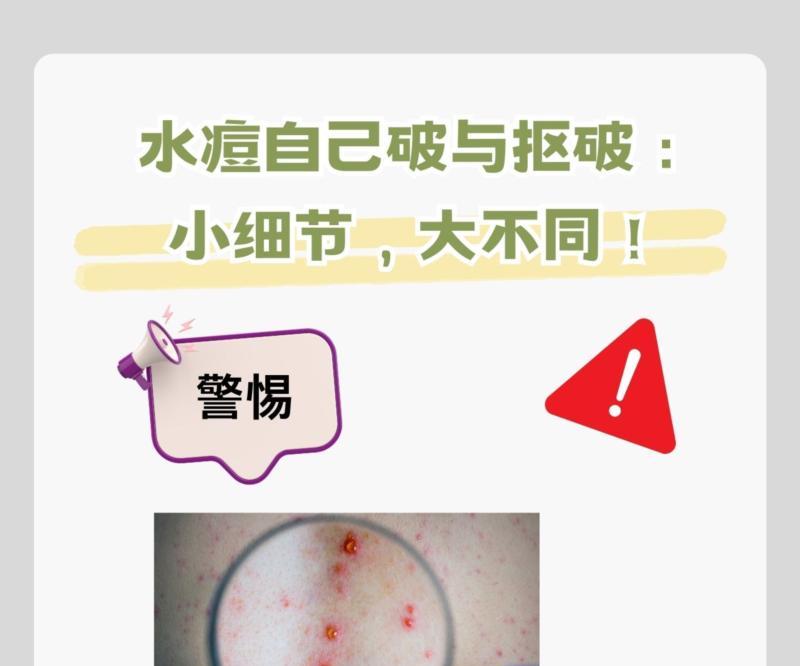 高级保育员模拟试题及答案2024年