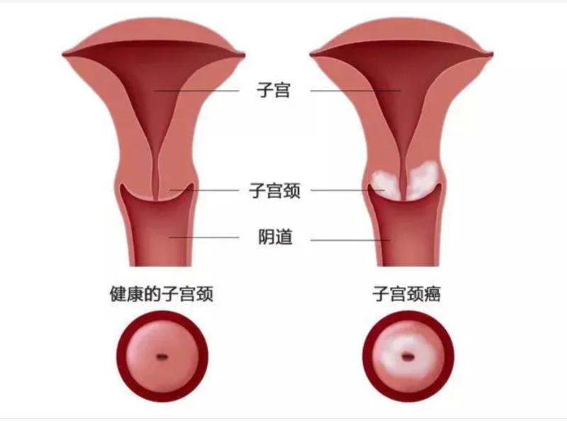 阴道英文怎么说