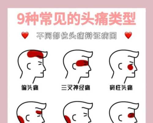 头痛的英语怎么读语音