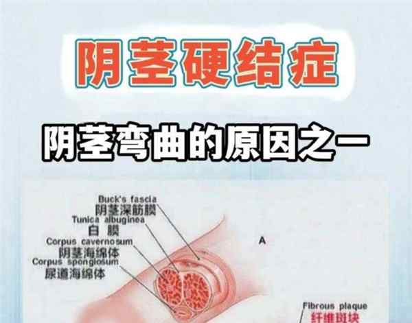 阴道英语怎么说