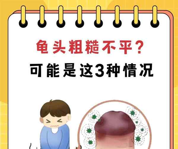 包含龟头英文的词条