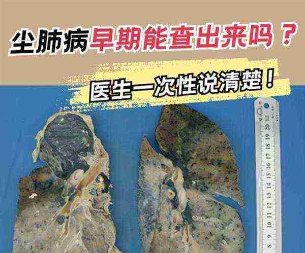 肺尘病英文怎么读全称